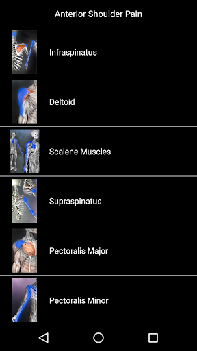 Muscle Trigger Point Anatomy