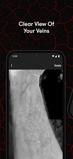 X-Vein