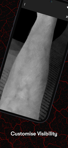 X-Vein
