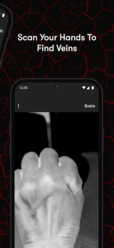 X-Vein