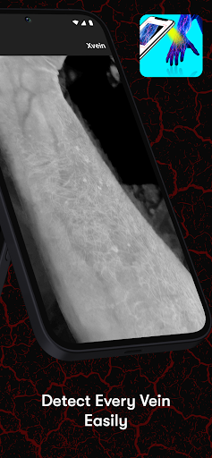 X-Vein