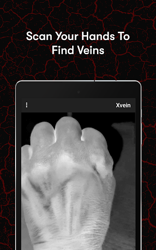 X-Vein