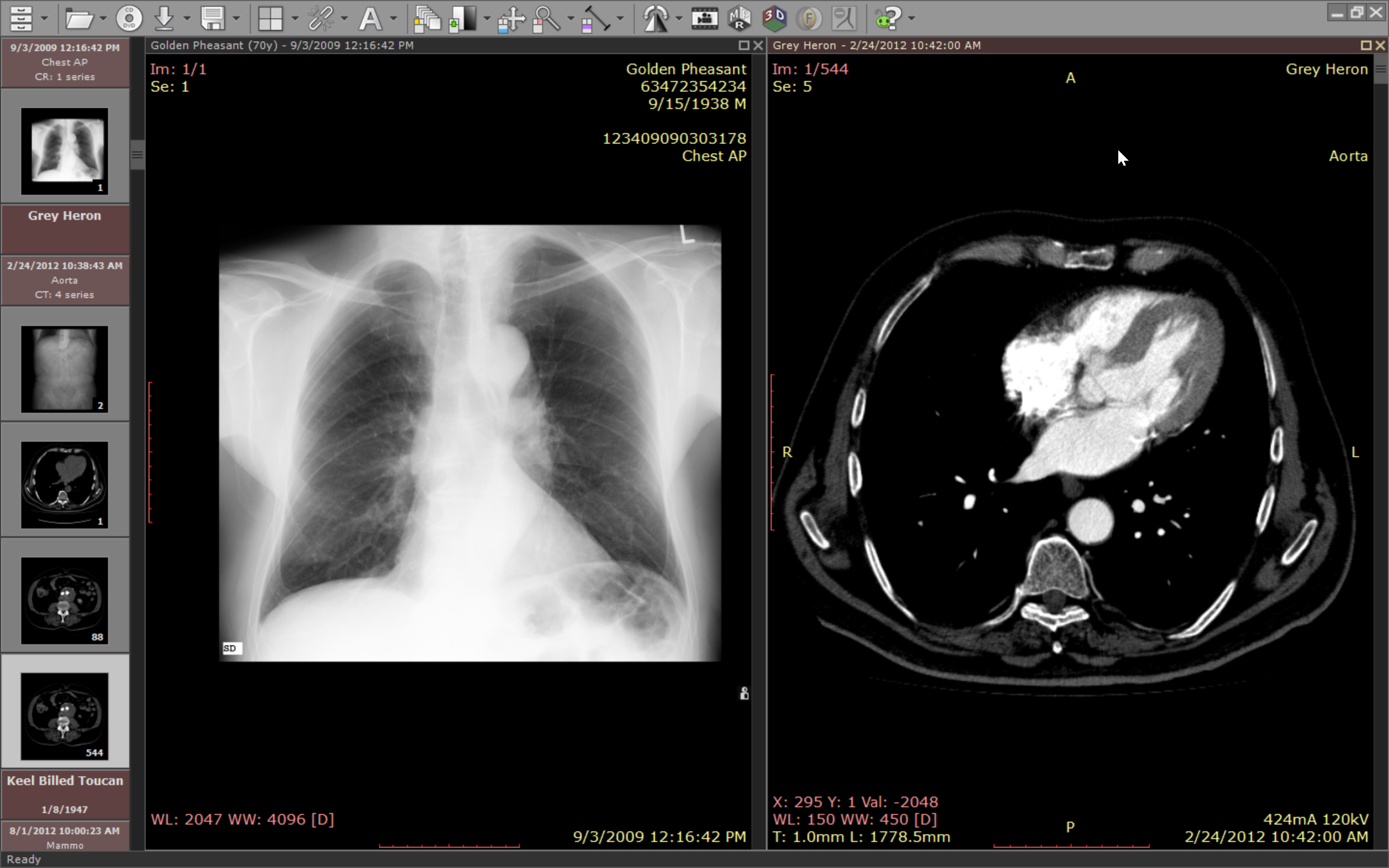 RadiAnt DICOM Viewer