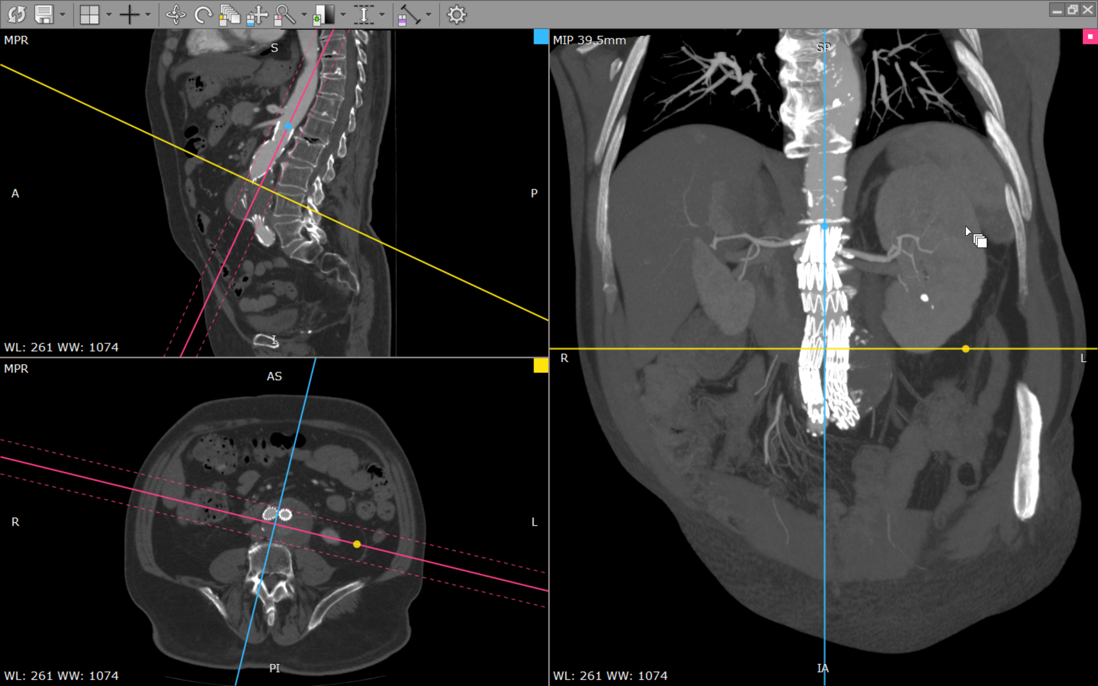 RadiAnt DICOM Viewer