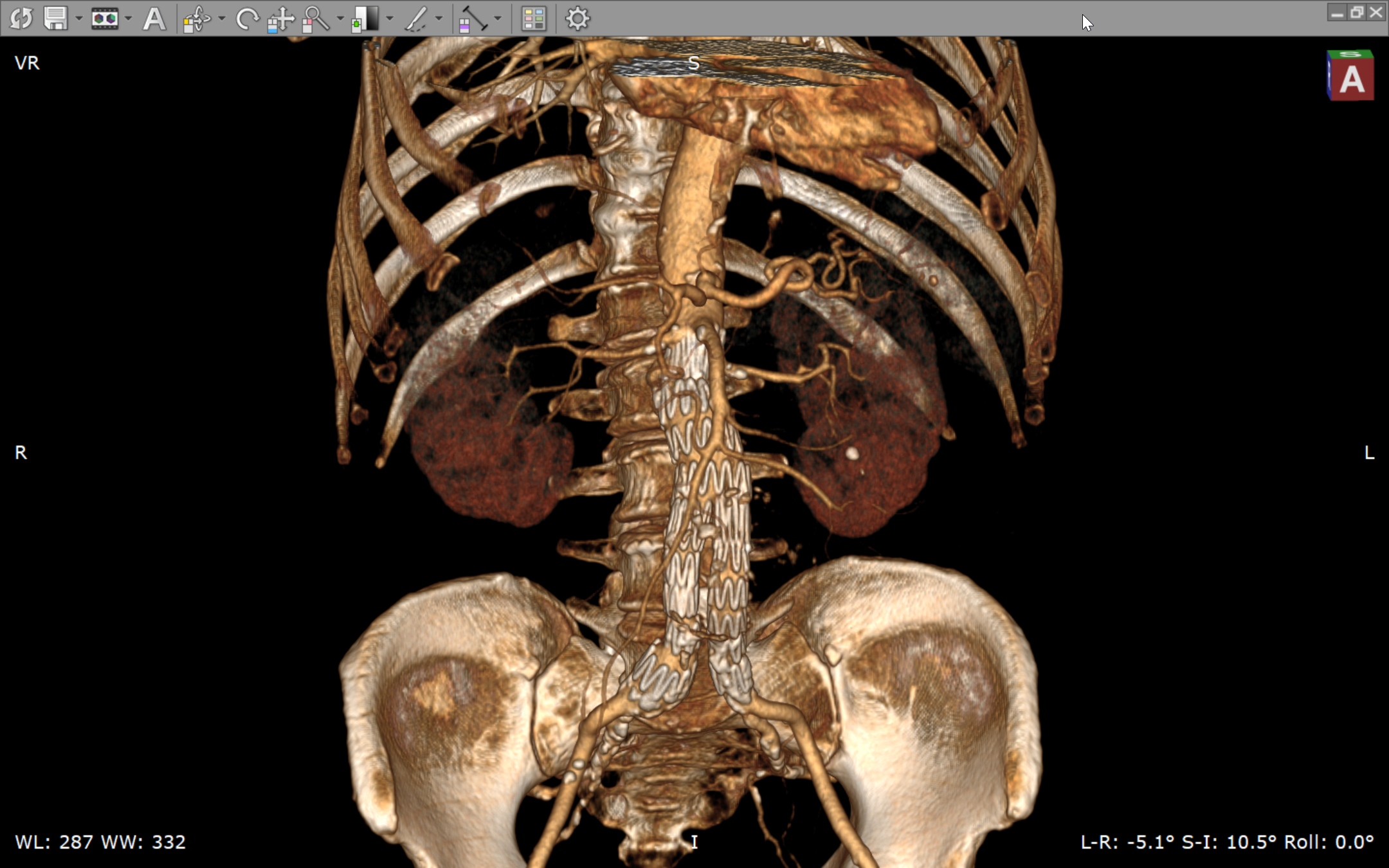 RadiAnt DICOM Viewer